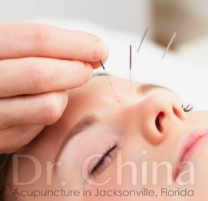 jacksonville acupuncture therapy